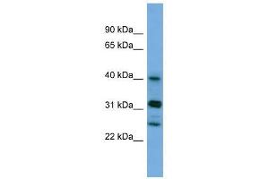 PPHLN1 antibody used at 0. (PPHLN1 anticorps  (N-Term))