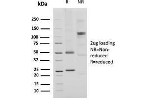 SDS-PAGE Analysis Purified CD74 Recombinant Rabbit Monoclonal Antibody (CLIP/3127R).