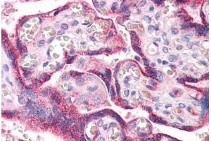 Human Placenta: Formalin-Fixed, Paraffin-Embedded (FFPE)