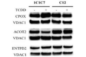 Western blot analysis of differentially expressed proteins identified by SILAC in hepatoma 1c1c7 and c12 cells exposed to DMSO or TCDD Source: PMID27105554 (ENTPD2 anticorps  (AA 401-495))