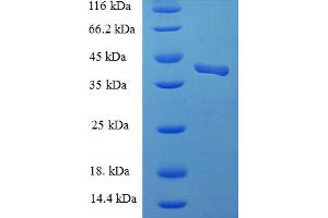 SDS-PAGE (SDS) image for Endothelial Cell Adhesion Molecule (ESAM) (AA 30-248), (Extracellular) protein (His-SUMO Tag) (ABIN5711668)