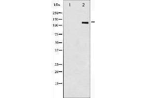 Western blot analysis of HDAC6 phosphorylation expression in NIH-3T3 whole cell lysates,The lane on the left is treated with the antigen-specific peptide. (HDAC6 anticorps  (pSer22))