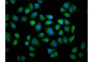 Immunofluorescence staining of Hela cells with ABIN7149243 at 1:133, counter-stained with DAPI.