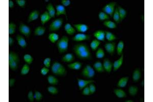 Immunofluorescence staining of Hela cells with ABIN7149243 at 1:133, counter-stained with DAPI. (CYP2C19 anticorps  (AA 245-353))