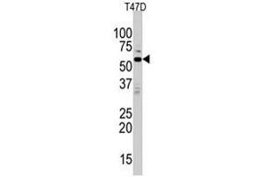 Western blot analysis of MAPK15 polyclonal antibody  in T-47D cell line lysates (35 ug/lane). (MAPK15 anticorps  (N-Term))