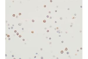 Immunocytochemistry (ICC) image for anti-Mitogen-Activated Protein Kinase Kinase 2 (MAP2K2) (AA 1-50) antibody (ABIN7454013)