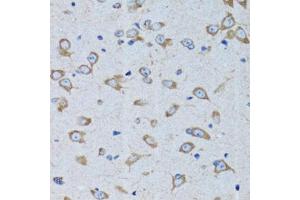 Immunohistochemistry of paraffin-embedded rat brain using RARS antibody (ABIN6127449, ABIN6146708, ABIN6146709 and ABIN6221913) at dilution of 1:100 (40x lens). (RARS anticorps  (AA 1-300))