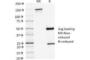 SDS-PAGE Analysis Purified TSH-Receptor, A-Chain Mouse Monoclonal Antibody (TSHRA/1402). (TSH receptor anticorps)