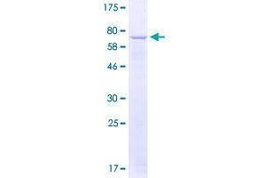 Image no. 1 for Potassium Voltage-Gated Channel, Shaker-Related Subfamily, beta Member 3 (KCNAB3) (AA 1-404) protein (GST tag) (ABIN1308395)