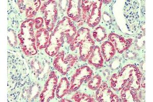 Human Kidney: Formalin-Fixed, Paraffin-Embedded (FFPE) (ANTXR2 anticorps)