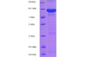 SDS-PAGE (SDS) image for Cadherin 1, Type 1, E-Cadherin (Epithelial) (CDH1) (AA 155-707), (partial) protein (His tag) (ABIN5709259)