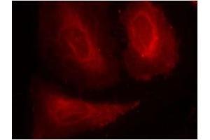 Image no. 3 for anti-3-phosphoinositide Dependent Protein Kinase-1 (PDPK1) (pSer241) antibody (ABIN196617) (PDPK1 anticorps  (pSer241))