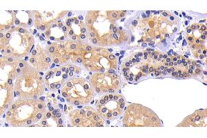 Detection of MMP7 in Human Kidney Tissue using Polyclonal Antibody to Matrix Metalloproteinase 7 (MMP7)