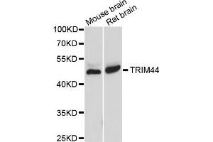 Western blot analysis of extracts of various cells, using TRIM44 antibody. (TRIM44 anticorps)
