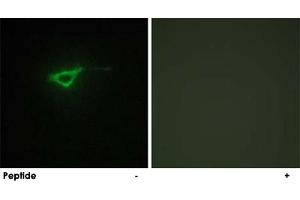 Immunofluorescence analysis of NIH/3T3 cells, using COL20A1 polyclonal antibody . (COL20A1 anticorps  (C-Term))