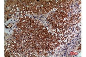 Immunohistochemistry (IHC) analysis of paraffin-embedded Human Brain, antibody was diluted at 1:100.
