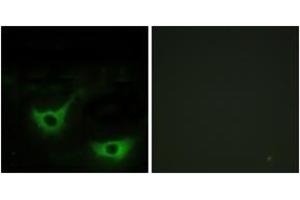 Immunofluorescence analysis of NIH-3T3 cells, using CALR Antibody. (Calreticulin anticorps  (AA 21-70))