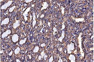 IHC analysis of Calnexin/CANX using anti-Calnexin/CANX antibody (ABIN7602290).