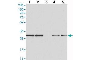 Western blot analysis of Lane 1: RT-4, Lane 2: U-251 MG, Lane 3: Human Plasma, Lane 4: Liver, Lane 5: Tonsil with MAPK1IP1L polyclonal antibody  at 1:250-1:500 dilution. (MAPK1IP1L anticorps)