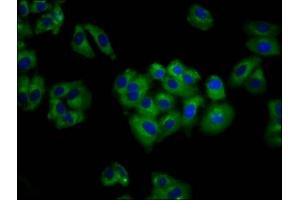 Immunofluorescence staining of HepG2 cells with ABIN7144312 at 1:100, counter-stained with DAPI. (Anoctamin 6 anticorps  (AA 12-100))