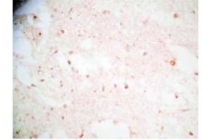 Human brain tissue was stained by Rabbit Anti-Synaptotagminm IV(73-97) (Human) Antibody