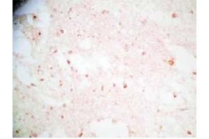 Human brain tissue was stained by Rabbit Anti-Synaptotagminm IV(73-97) (Human) Antibody (SYT4 anticorps  (AA 73-97))