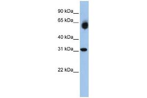 WB Suggested Anti-DHRS2  Antibody Titration: 0. (DHRS2 anticorps  (Middle Region))