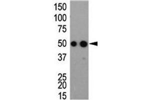 Western blot analysis of HA antibody and tagged recombinant protein bacterial lysate (HA-Tag anticorps)