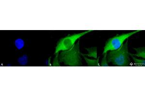 Immunocytochemistry/Immunofluorescence analysis using Rabbit Anti-Hsp70 Polyclonal Antibody . (HSP70 anticorps  (PE))