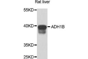 Western blot analysis of extracts of rat liver cells, using ADH1B antibody. (ADH1B anticorps)