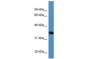 Western Blot showing Upp2 antibody used at a concentration of 1.