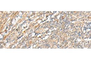 Immunohistochemistry of paraffin-embedded Human tonsil tissue using PCSK5 Polyclonal Antibody at dilution of 1:35(x200) (PCSK5 anticorps)
