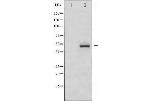 Western blot analysis of CrkII expression in COS7 whole cell lysates,The lane on the left is treated with the antigen-specific peptide. (Crk anticorps)