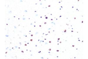 Immunohistochemistry of paraffin-embedded rat brain using PRPF8 Rabbit mAb (ABIN7269737) at dilution of 1:100 (40x lens).