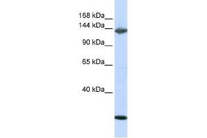 Jagged 2 antibody used at 1 ug/ml to detect target protein.