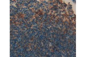 Used in DAB staining on fromalin fixed paraffin- embedded Kidney tissue (KLRK1 anticorps  (AA 92-216))