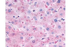 Anti-GCGR / Glucagon Receptor antibody IHC of human liver.