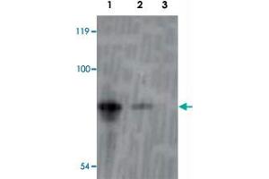 Western blot analysis of recombinant inaD protein using inaD polyclonal antibody  at 1:1000 dilution. (Inactivation No Afterpotential D (INAD) (AA 659-674) anticorps)