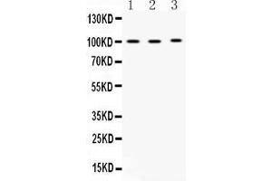 Western blot analysis of ADAM2 expression in rat testis extract ( Lane 1), mouse testis extract ( Lane 2) and MCF-7 whole cell lysates ( Lane 3). (ADAM2 anticorps  (N-Term))
