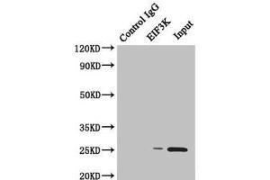 Immunoprecipitating EIF3K in Hela whole cell lysate Lane 1: Rabbit control IgG instead of (1 μg) instead of ABIN7152170 in Hela whole cell lysate.