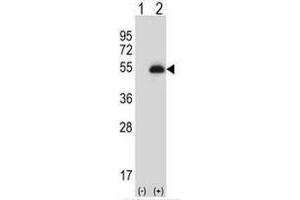 Western blot analysis of PAX6 (arrow) using rabbit polyclonal PAX6 Antibody . (PAX6 anticorps)