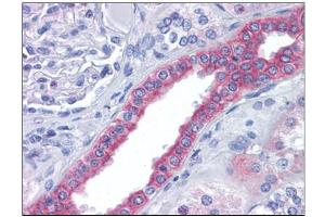 Human Kidney: Formalin-Fixed, Paraffin-Embedded (FFPE) (FAM33A anticorps  (N-Term))