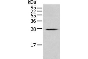 Western blot analysis of K562 cell using MOB1B Polyclonal Antibody at dilution of 1:250 (MOBKL1A anticorps)