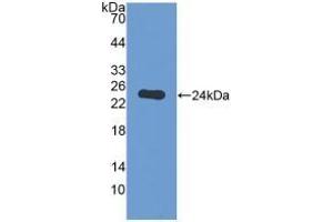 Detection of Recombinant GAMT, Human using Polyclonal Antibody to Guanidinoacetate-N-Methyltransferase (GAMT)