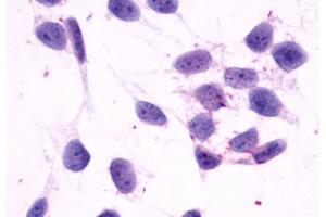 Image no. 2 for anti-Histamine Receptor H4 (HRH4) (C-Term) antibody (ABIN1048965) (HRH4 anticorps  (C-Term))