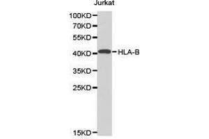 Western Blotting (WB) image for anti-Major Histocompatibility Complex, Class I, B (HLA-B) antibody (ABIN1873025) (HLA-B anticorps)