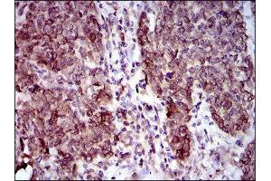 Immunohistochemistry (IHC) image for anti-Calmegin (CLGN) (AA 249-405) antibody (ABIN1843003)