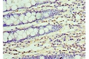 Immunohistochemistry of paraffin-embedded human colon tissue using ABIN7174370 at dilution of 1:100 (UCHL3 anticorps  (C-Term))