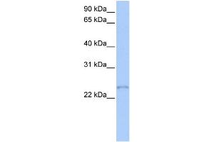 WB Suggested Anti-TCEAL1 Antibody Titration:  0. (TCEAL1 anticorps  (Middle Region))