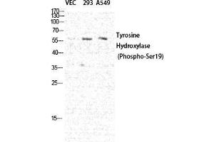 Western Blot (WB) analysis of specific cells using Phospho-TH (S19) Polyclonal Antibody. (TH anticorps  (pSer19))
